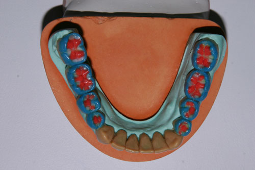 Encerado Diagnostico 2