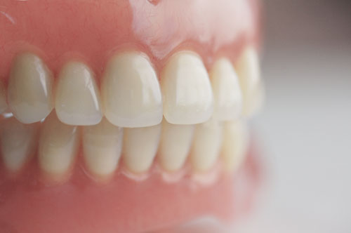 Protesis Total Provisional