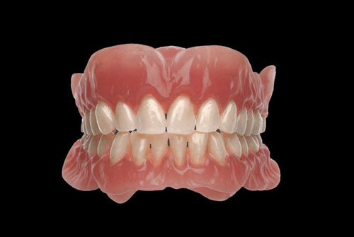 Protesis Total simple